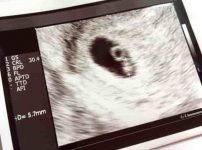 川越市「愛和病院」妊娠2カ月目の健診内容